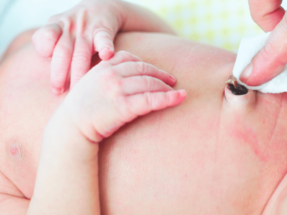 Como cuidar do coto umbilical do recém- nascido