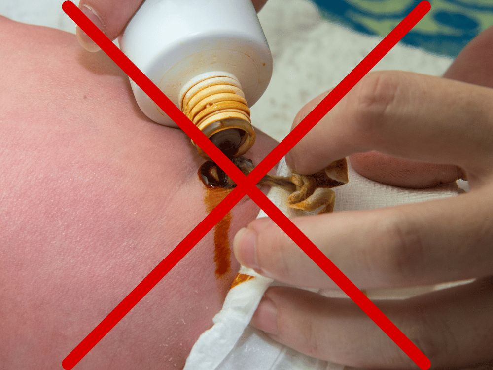 Mitos sobre o umbigo do bebê